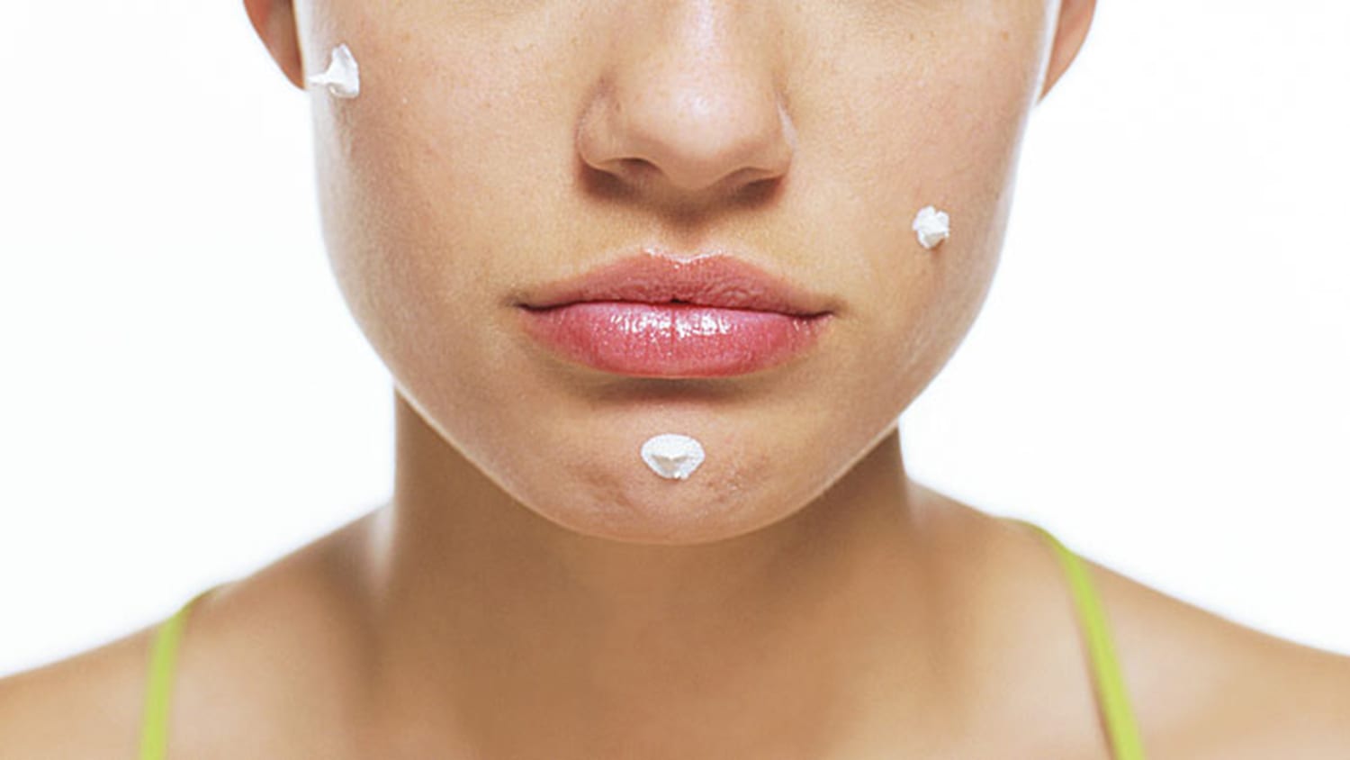 How to get rid of acne: Easy home remedies, clearskin 