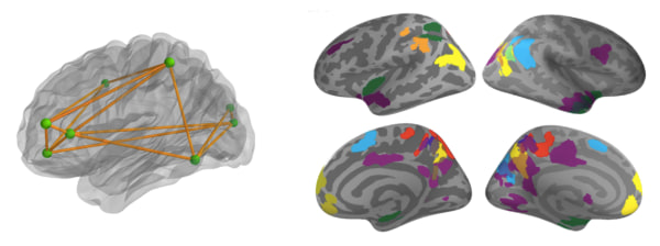 Image: Brain Scans May Predict Math Gains