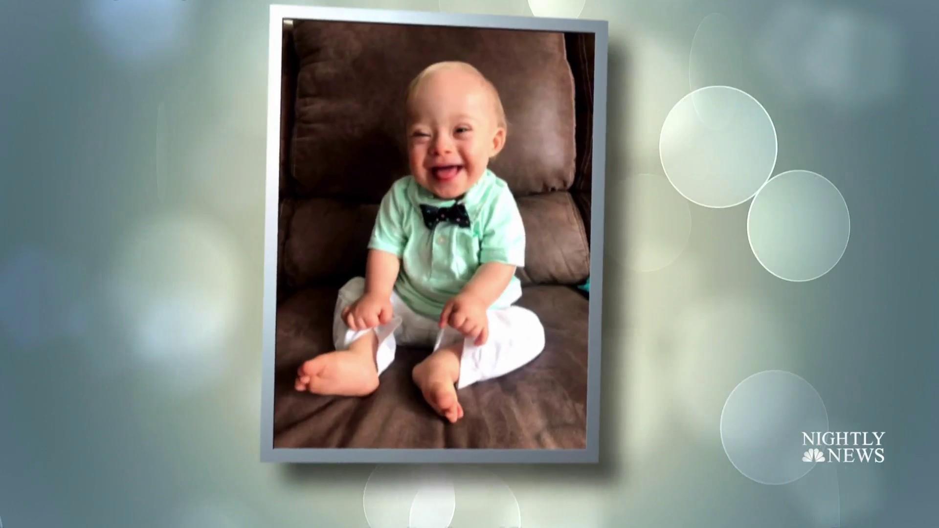 This year's Gerber baby has Down syndrome