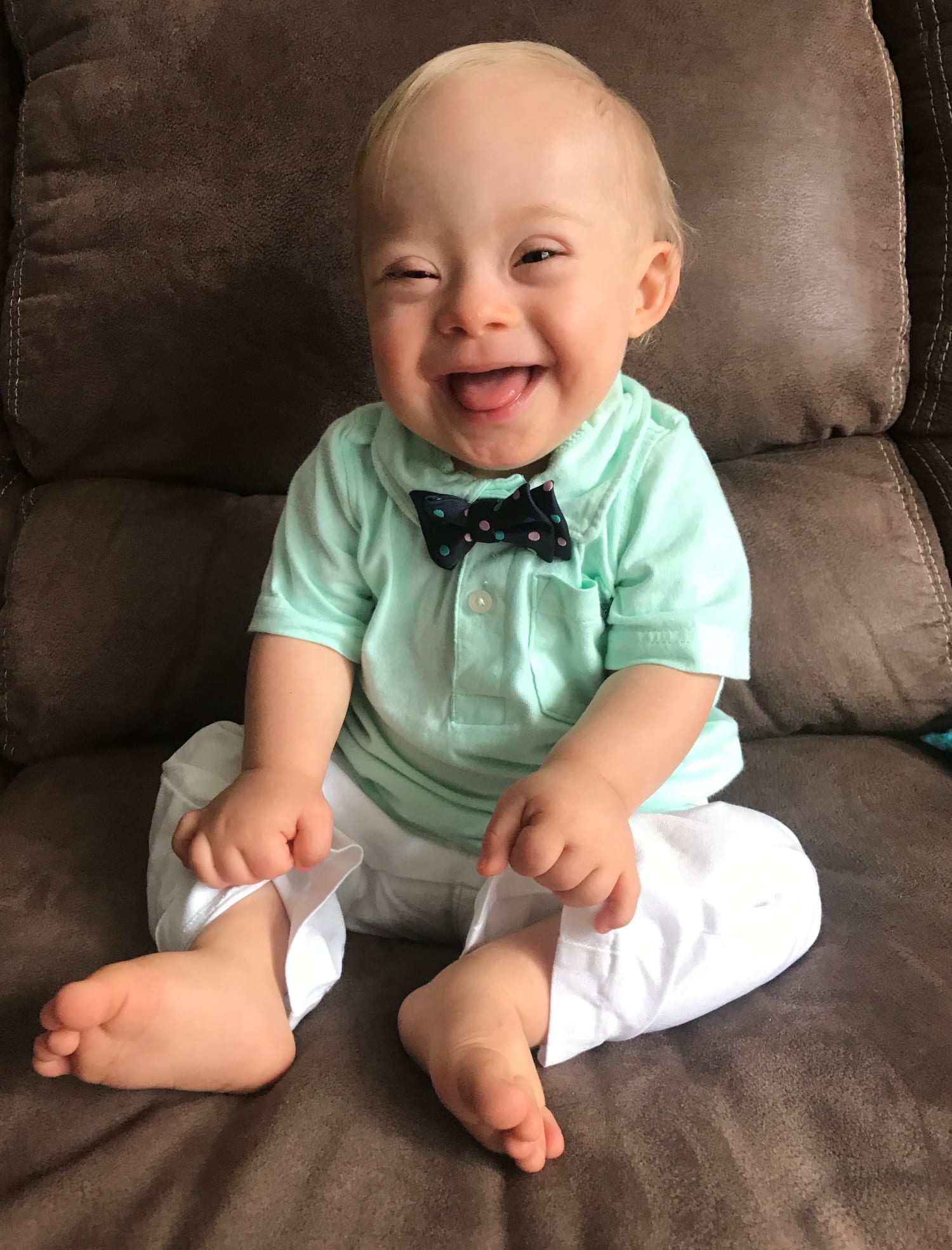 first Gerber baby with Down syndrome