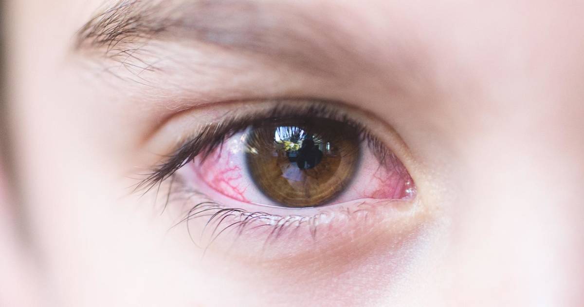 how long is pink eye contagious for
