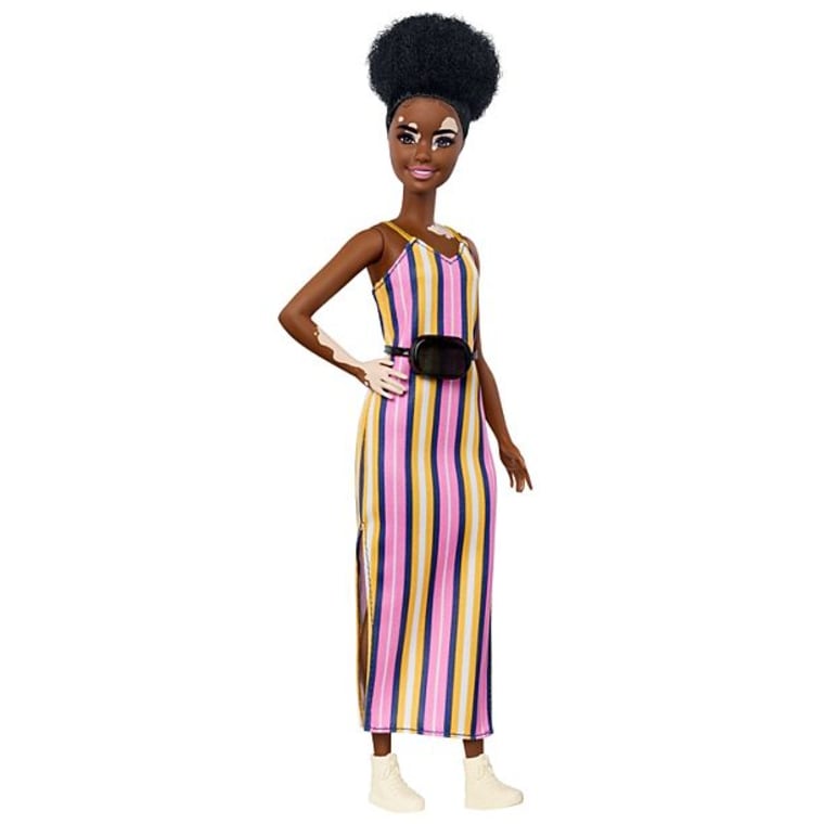 Mattel says they worked with a dermatologist to ensure their Fashionista with vitiligo was accurately portrayed.