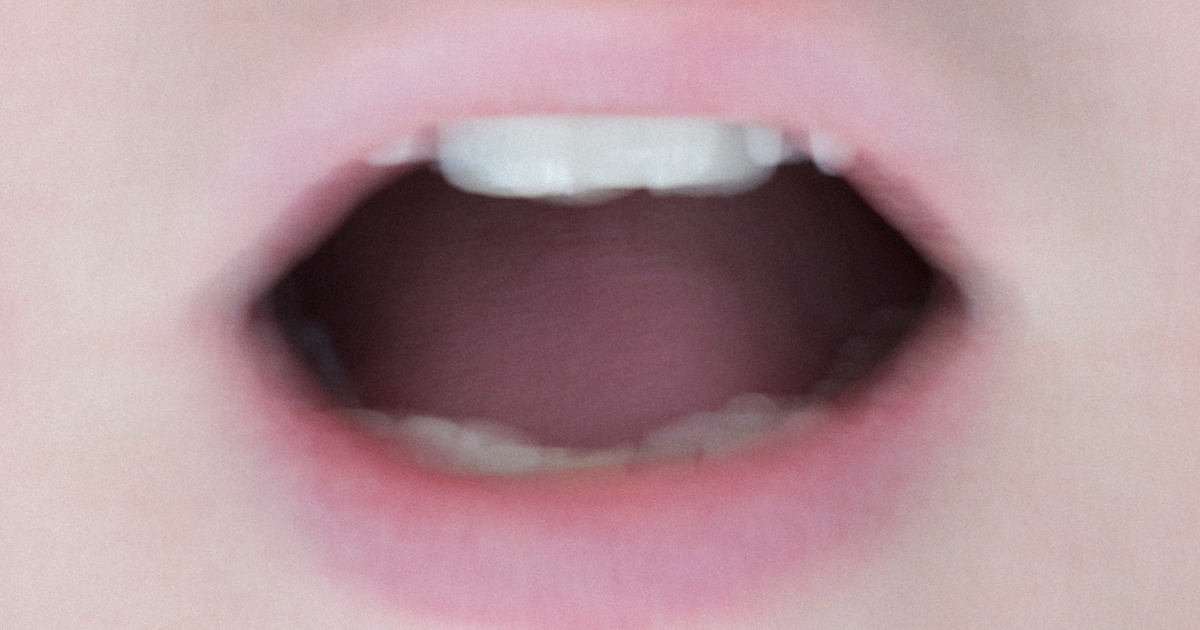 What is the COVID language?  Swollen and sore tongue may be a possible symptom of coronavirus